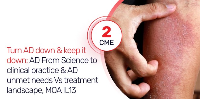 Turn Atopic Dermatitis down & Keep it Down & AD unmet needs Vs treatment landscape, MOA IL13