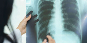 Introduction to Chest Radiology