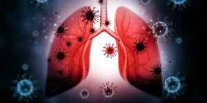 Upper respiratory track infection