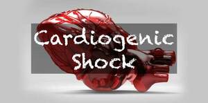 Cardiogenic Shock