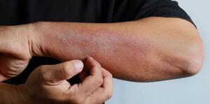 Dermatology Emergency Crash Course - Part 2