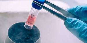 Revolution of stem cell