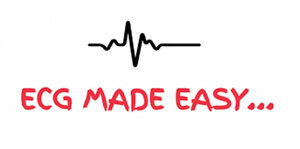 ECG Made Easy