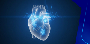 Atrial  Fibrillation