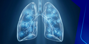 High Frequency Jet Ventilation (HFJV)