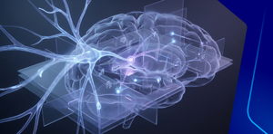 Panl Discussion : Case Scinario (Stroke)