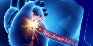 الجلطات القلبية