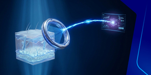 DermaX: Teledermatology experience