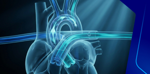 Duct dependent lesions CHD, What you should know about to improve outcome.