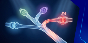 The Path to Diagnosis: Differentiating RA from Other Joints Diseases