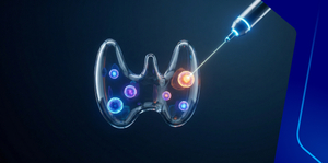 Approach to Thyroid Nodules