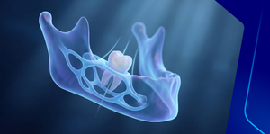 Interceptive Treatment in Holistic Orthodontics