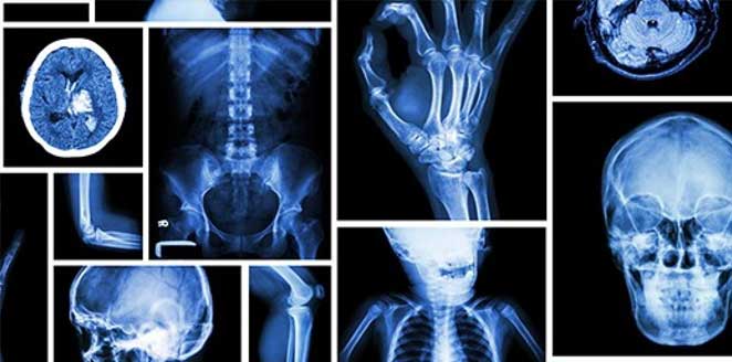 Basic of Radiology