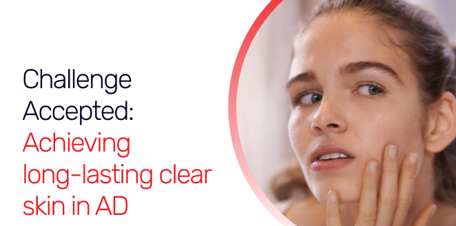 Challenge Accepted: Achieving long-lasting clear skin in AD