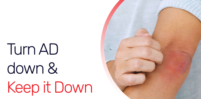 Turn AD down & Keep it Down