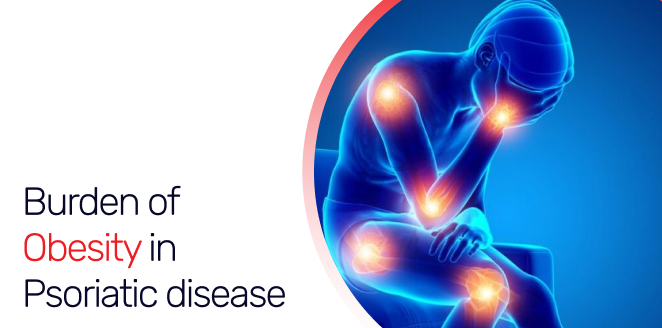 Burden of Obesity in Psoriatic disease