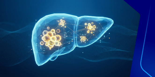 Fatty Liver Disease: Current Understanding, Risk Factors, and Management Strategies